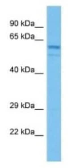 Carboxylesterase 1C/CES1C Rabbit anti-Mouse, Polyclonal, Novus Biologicals:Antibodies:Primary